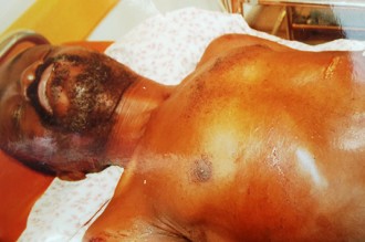 Gabon : Un homme dans le coma après avoir été tabassé par des policiers